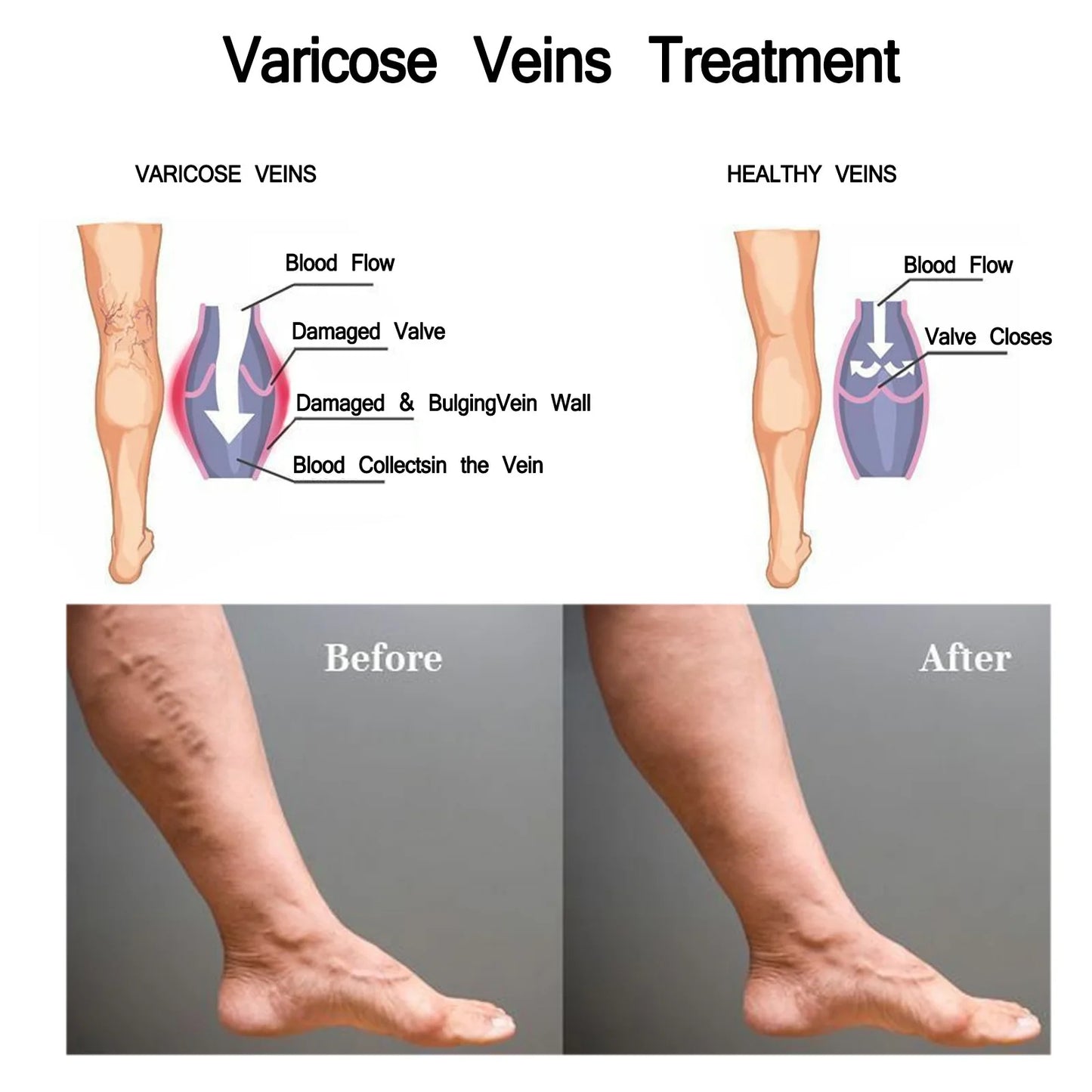 Vein Relief Patch
