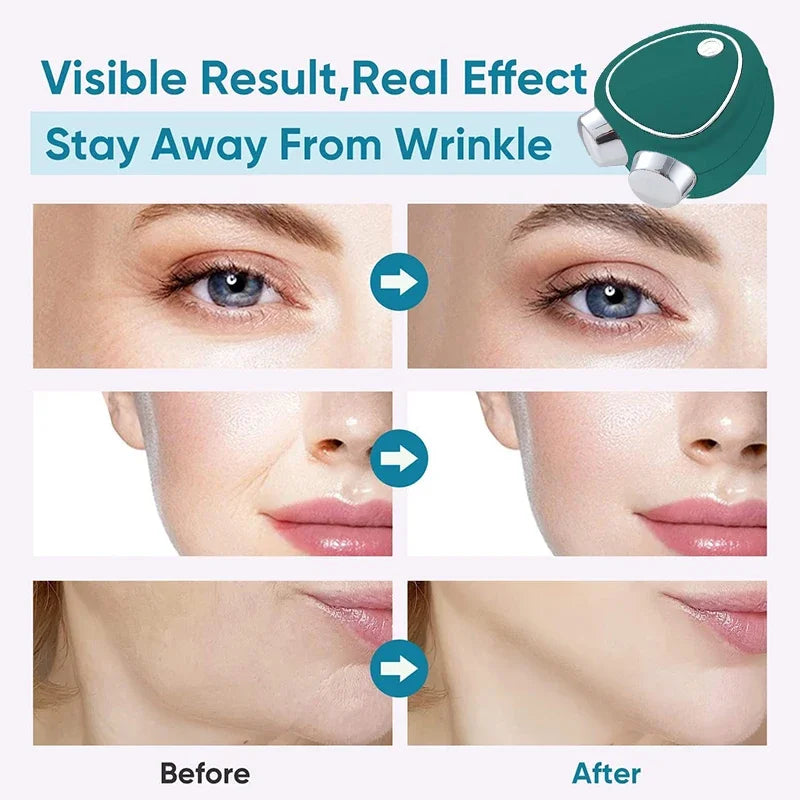 Electric EMS Face Lift Roller