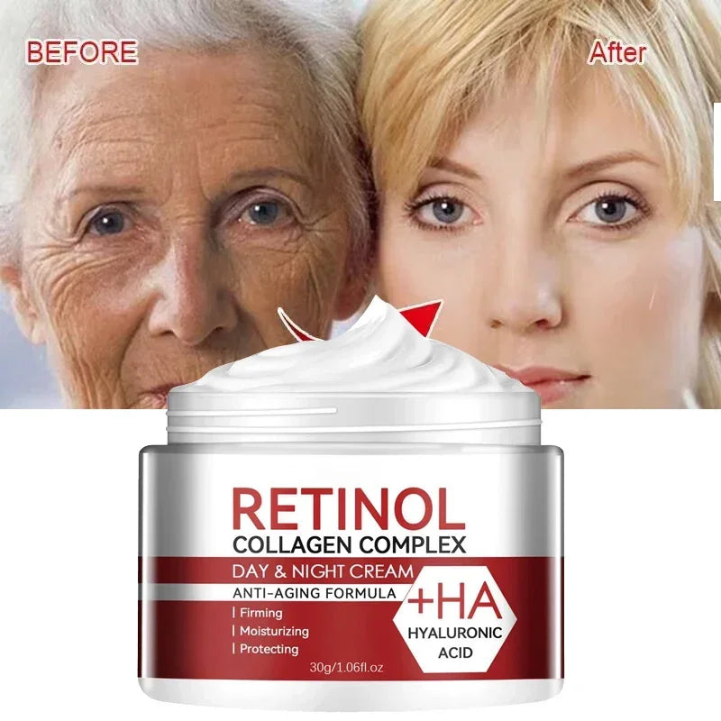 Wrinkle Erase Cream