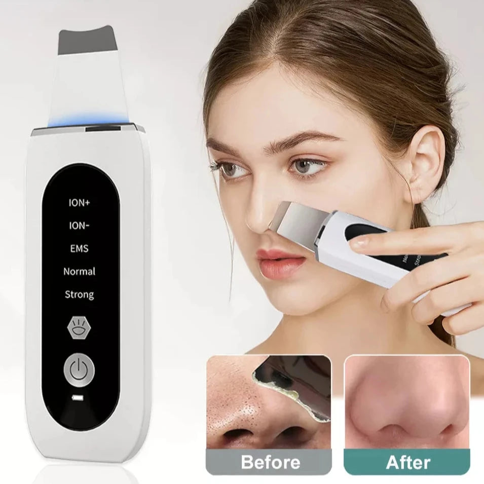 Ultrasonic Skin Scrubber Peeling